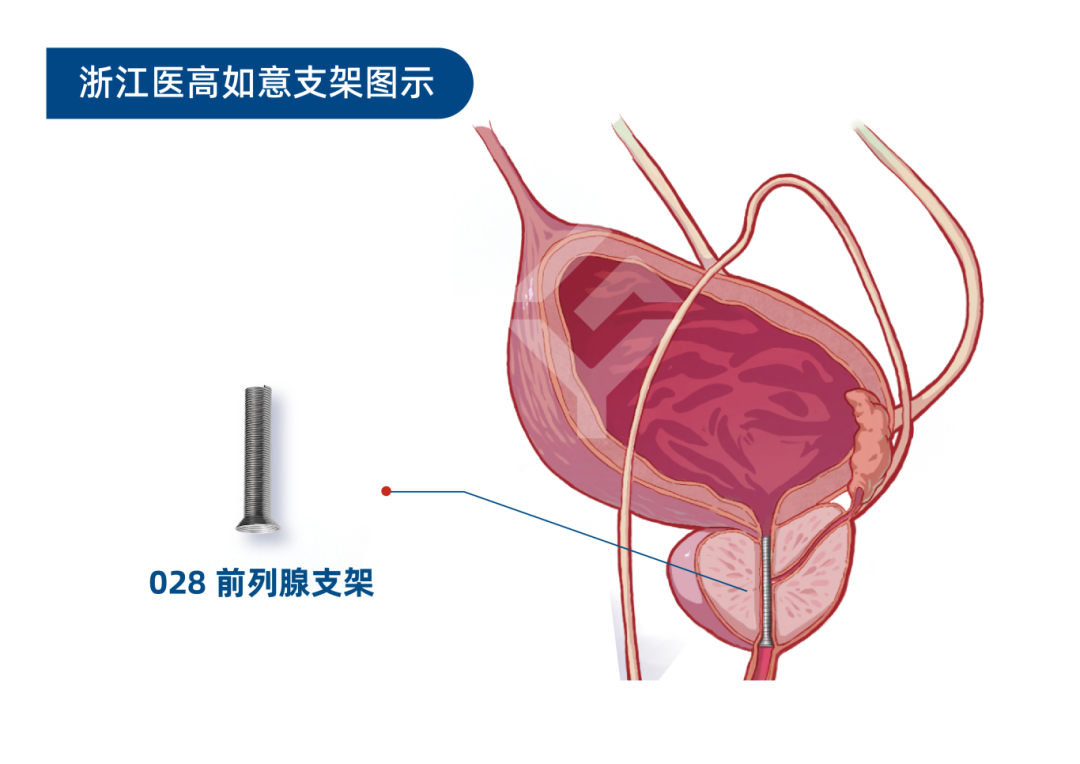 b572ec1e437fe55f06fc04ea5ee1df94.png